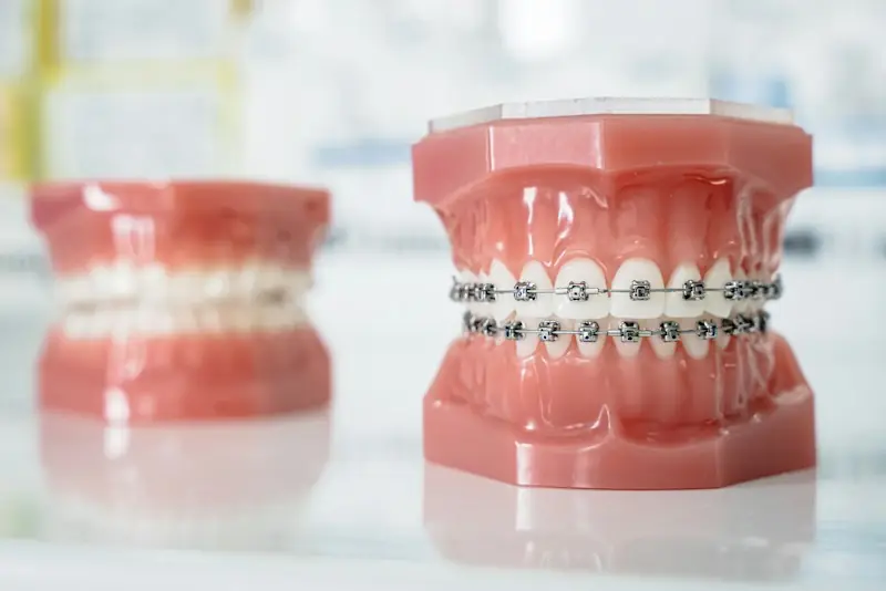 Dental models with and without braces