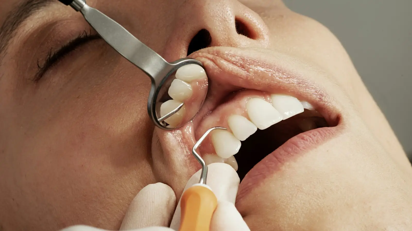 A dental check-up with a mirror and probe