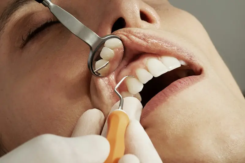 A dental check-up with a mirror and probe
