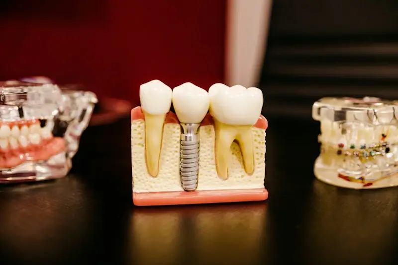 A dental implant model between natural teeth