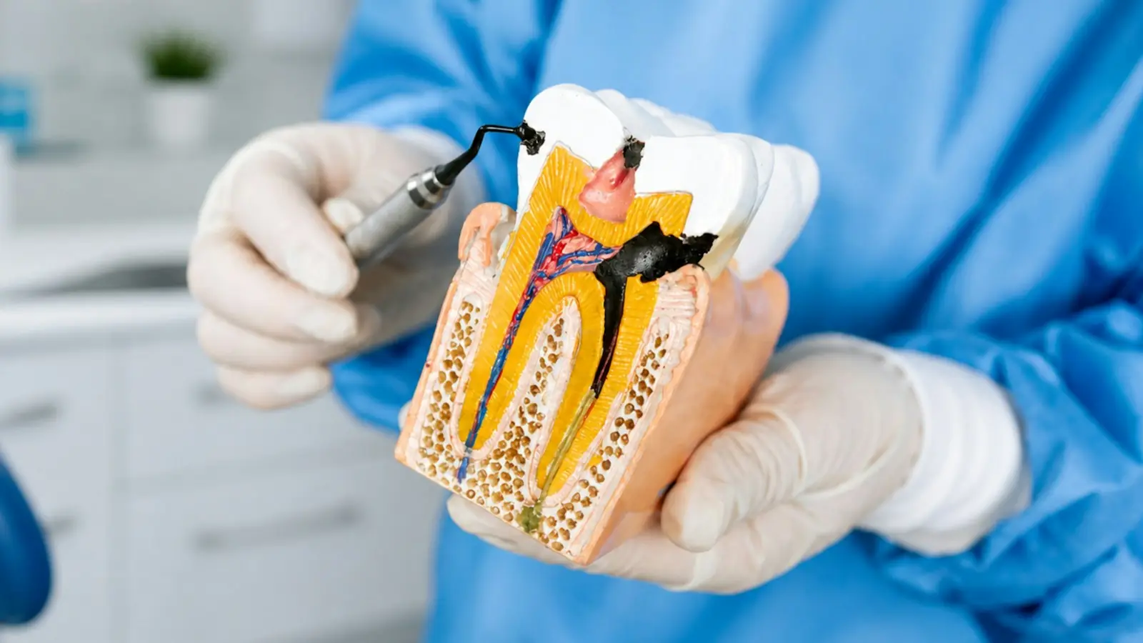 A cut-away tooth model showing the root canals