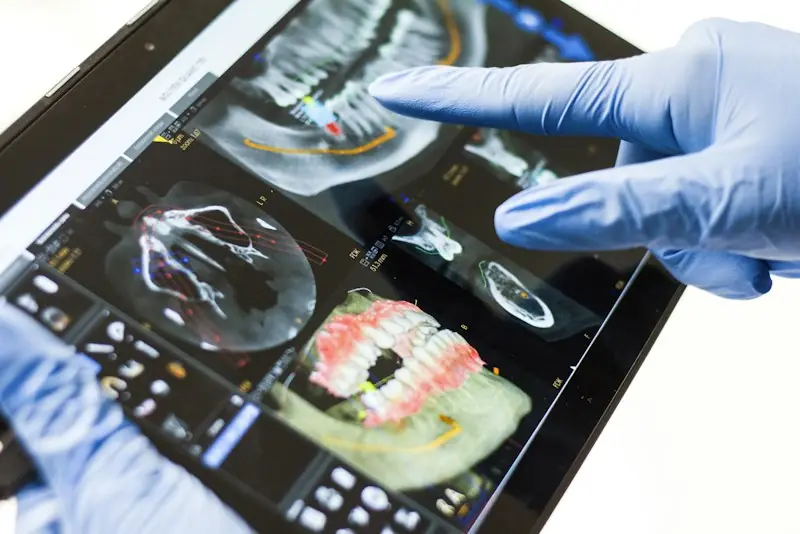 A gloved hand pointing at a 3D dental scan on a tablet