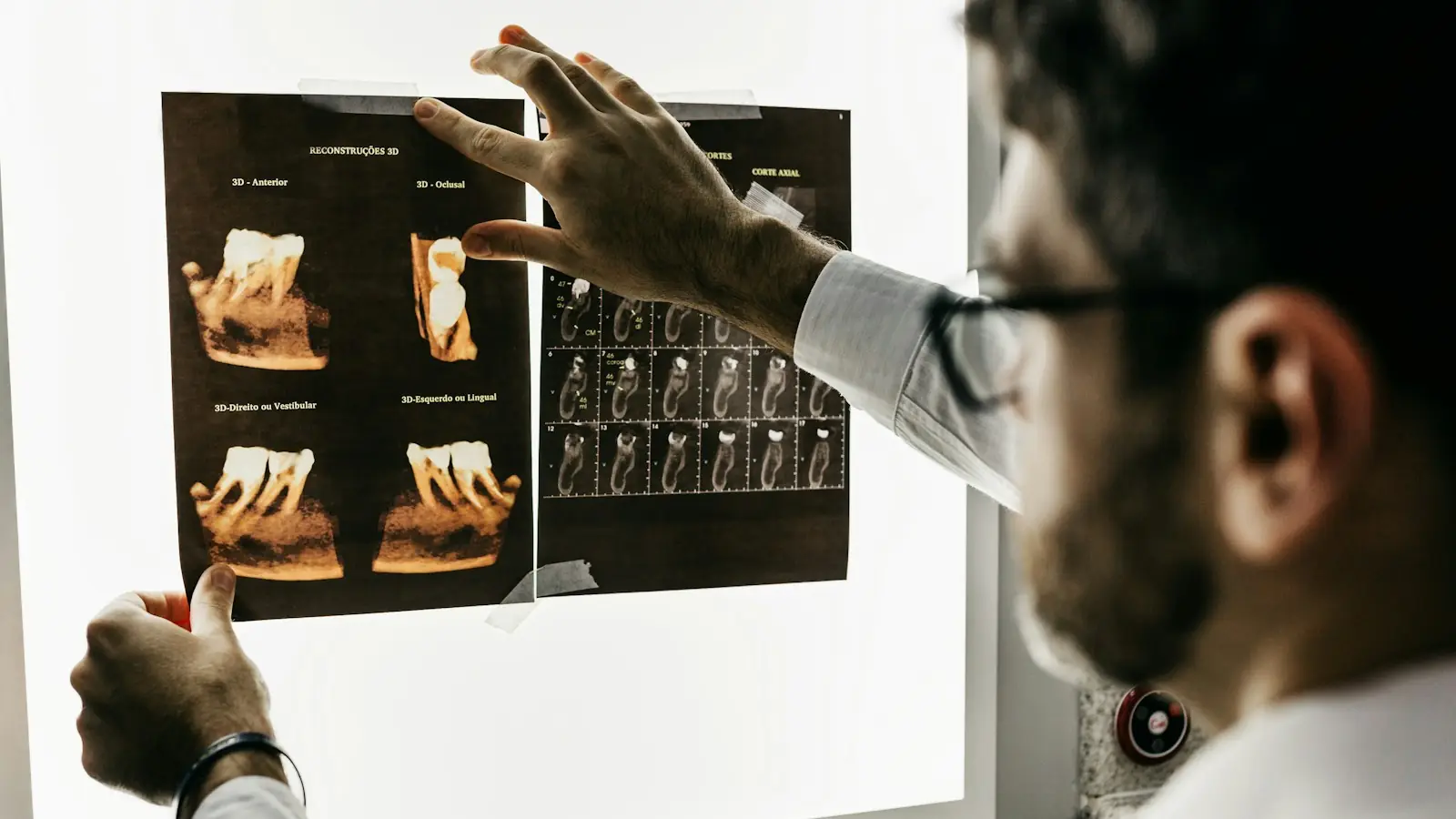 A dentist studying dental X-rays on a light box